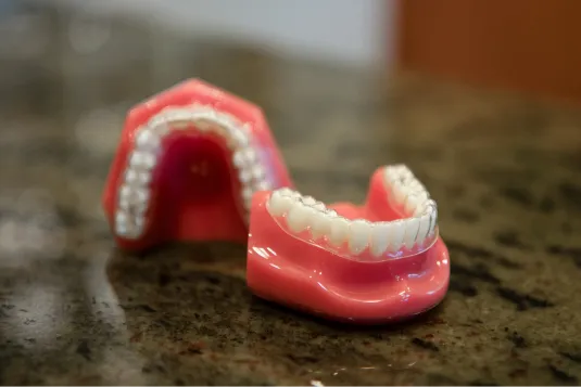 model of teeth