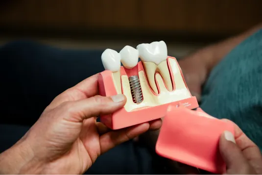 model of teeth