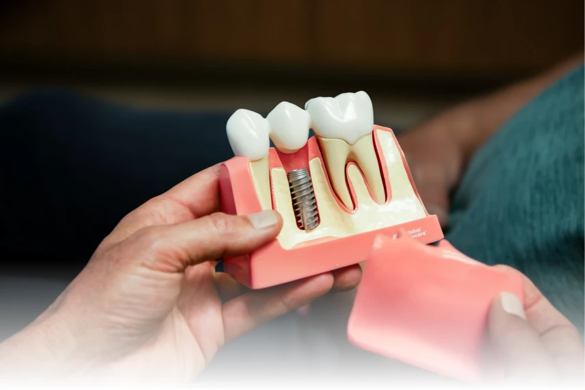 model of teeth